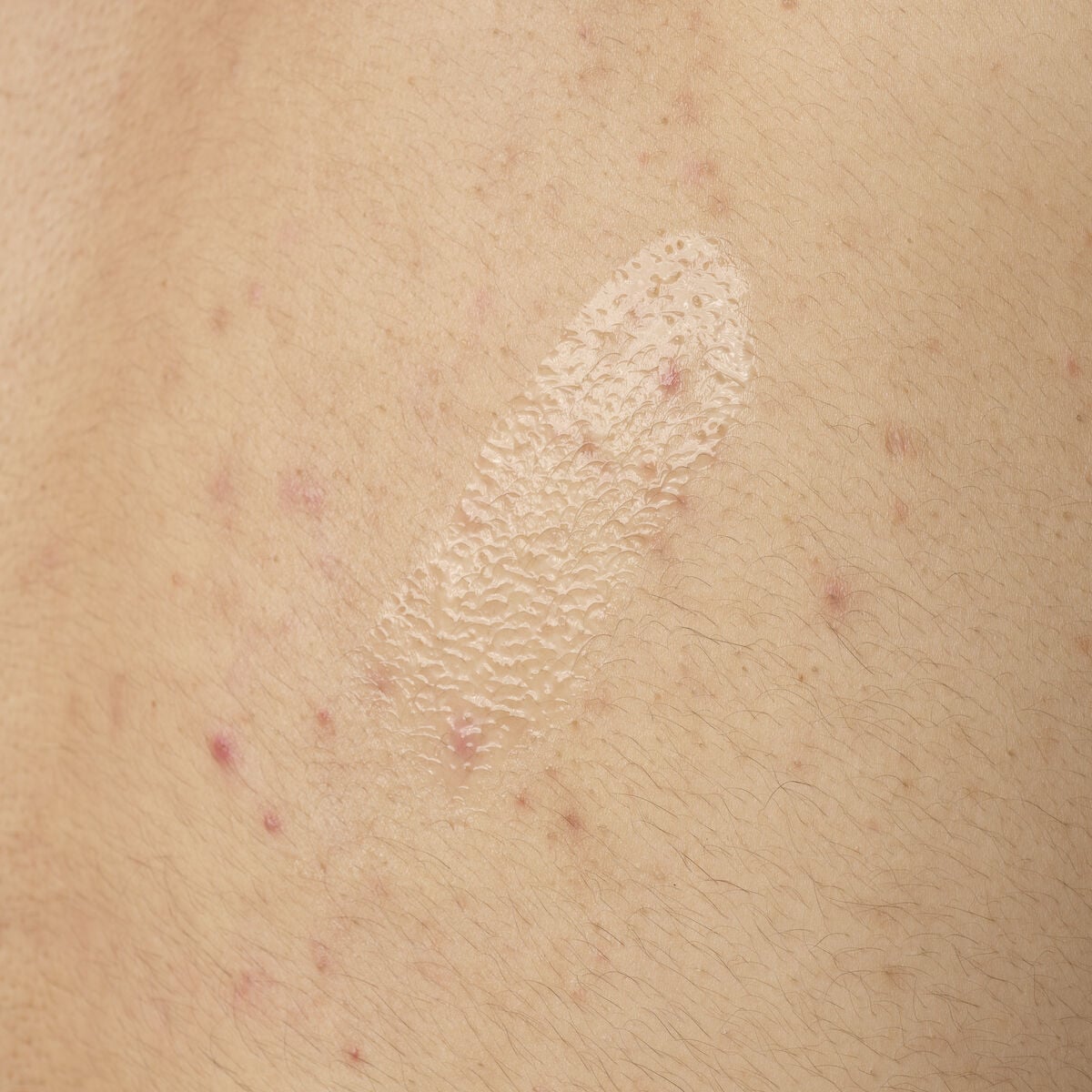 salicylic-acid-0-5-body-serum-n7 ORD-salicylic-acid-05-body-240ml-application.jpg