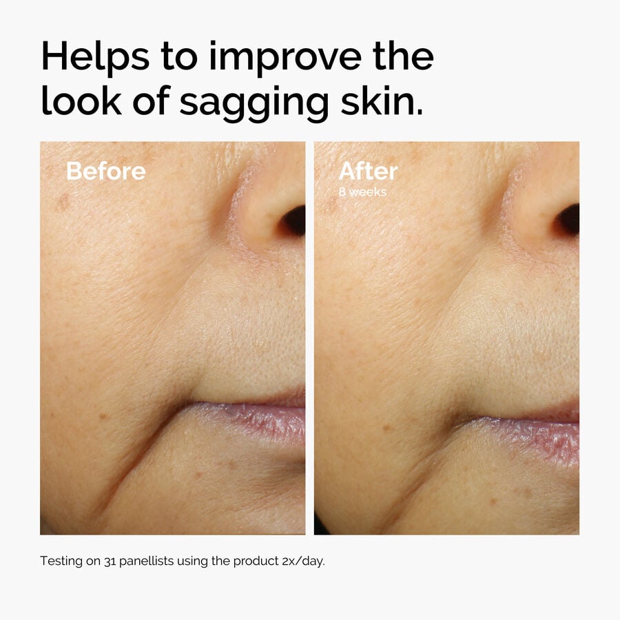 caffeine-3-escin-1-face-serum-l4 ord-caffeine-3pct-escin-1pct-face-serum-before-after-sagging.jpg