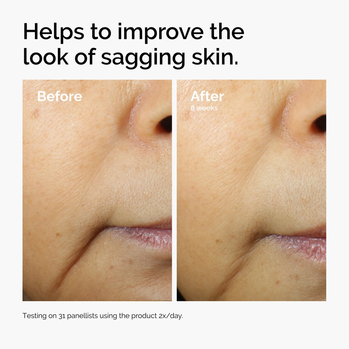 caffeine-3-escin-1-face-serum-l4 ord-caffeine-3pct-escin-1pct-face-serum-before-after-sagging.jpg