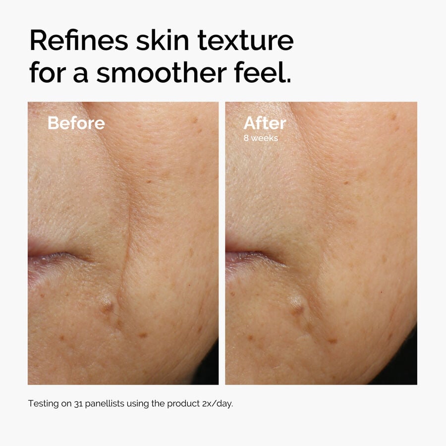 caffeine-3-escin-1-face-serum-l4 ord-caffeine-3pct-escin-1pct-face-serum-before-after-texture.jpg