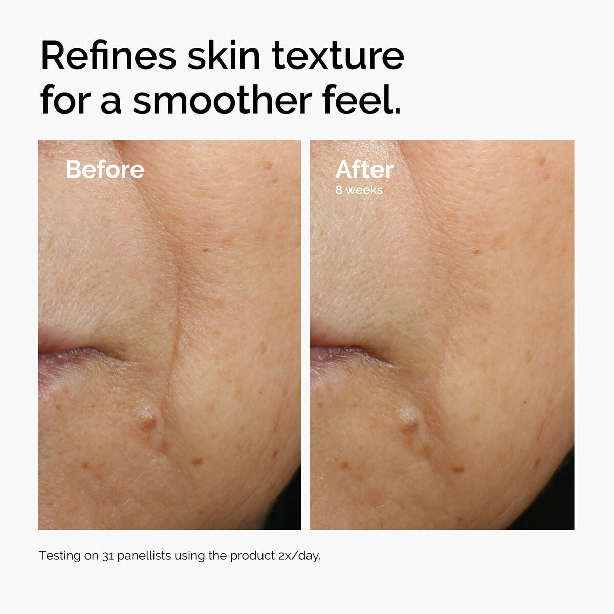 caffeine-3-escin-1-face-serum-l4 ord-caffeine-3pct-escin-1pct-face-serum-before-after-texture.jpg