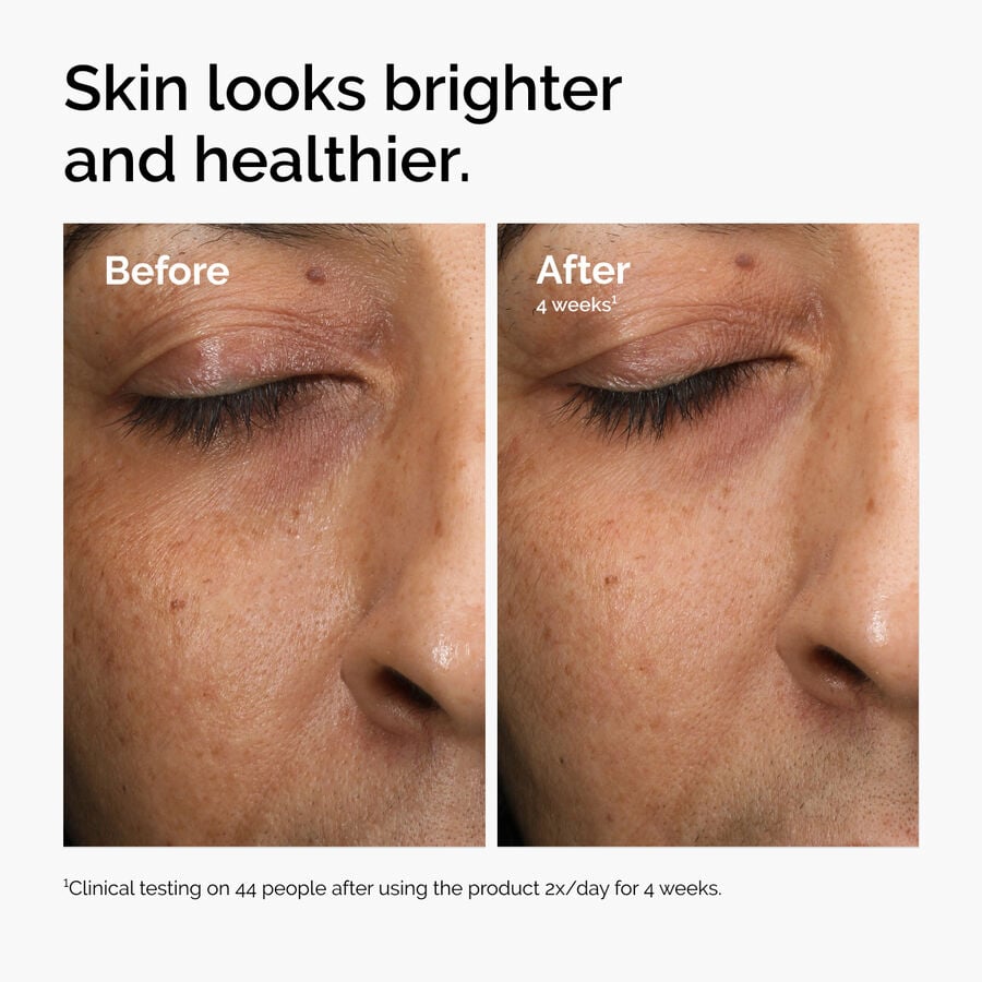 multi-antioxidant-radiance-serum-r5 ord-mars-before-after-healthy.jpg