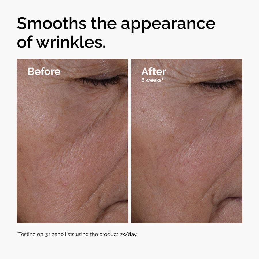 multi-peptide-ha-serum-e5 ord-multi-peptide-ha-serum-wrinkles-before-after.jpg