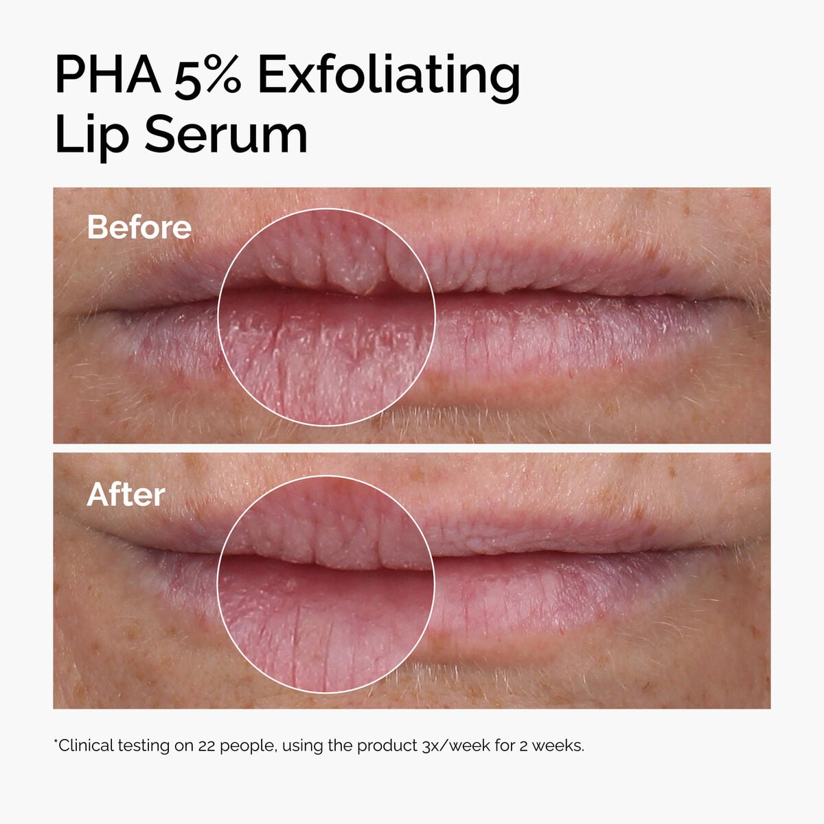 pha-5-exfoliating-lip-serum-t6 ord-pha-5pct-lip-exfoliating-serum-before-after.jpg
