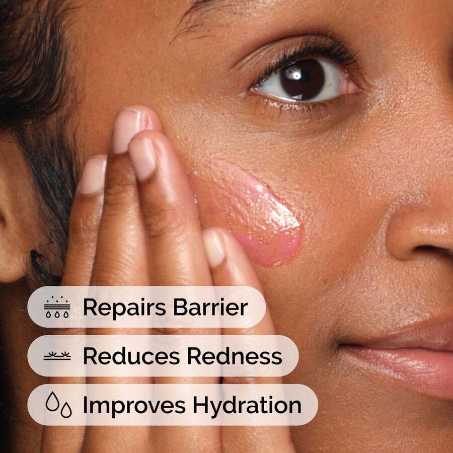 soothing-and-barrier-support-serum-f3 ord-soothing-barrier-support-serum-model-application-with-benefits.jpg