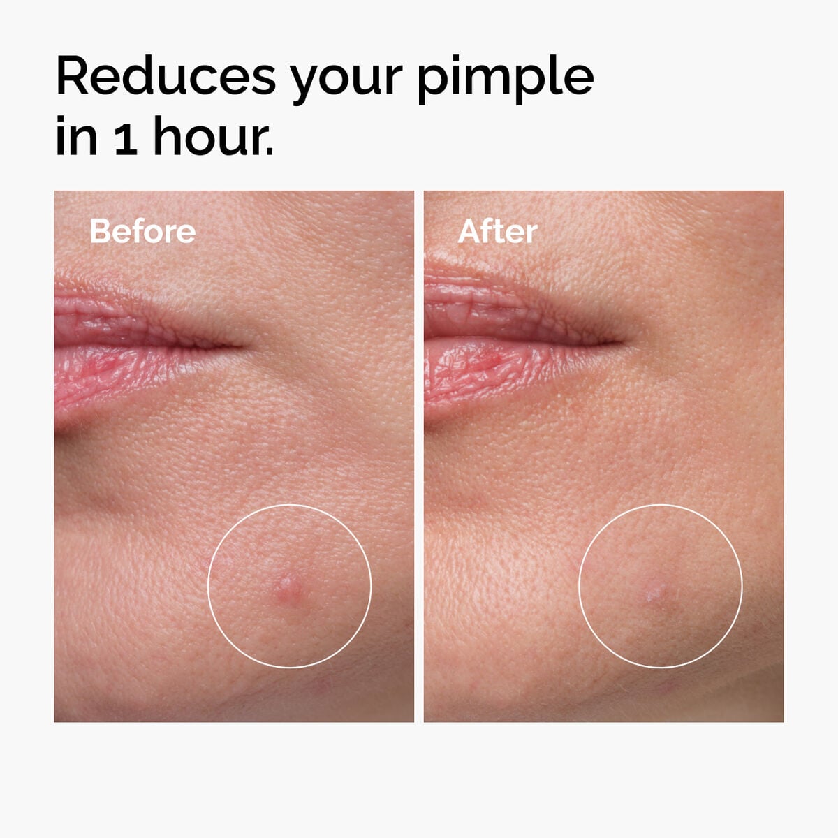 sulfur-10-powder-to-cream-concentrate-i9 ord-sulfur-10pct-powder-to-cream-concentrate-before-after-NA.jpg